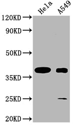 Western Blot
Positive WB detected in: Hela whole cell lysate, A549 whole cell lysate
All lanes: TAS2R7 antibody at 1:2000
Secondary
Goat polyclonal to rabbit IgG at 1/50000 dilution
Predicted band size: 37 kDa
Observed band size: 37 kDa