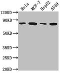 Western Blot
Positive WB detected in: Hela whole cell lysate, MCF-7 whole cell lysate, HepG2 whole cell lysate, A549 whole cell lysate
All lanes: GRHL1 antibody at 1:2000
Secondary
Goat polyclonal to rabbit IgG at 1/50000 dilution
Predicted band size: 71, 50, 58 kDa
Observed band size: 71 kDa
