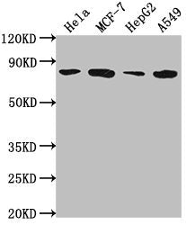 Western Blot
Positive WB detected in: Hela whole cell lysate, MCF-7 whole cell lysate, HepG2 whole cell lysate, A549 whole cell lysate
All lanes: GRHL1 antibody at 1:2000
Secondary
Goat polyclonal to rabbit IgG at 1/50000 dilution
Predicted band size: 71, 50, 58 kDa
Observed band size: 71 kDa