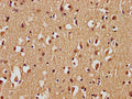 IHC image of CSB-PA868390PA01HU diluted at 1:100 and staining in paraffin-embedded human brain tissue performed on a Leica BondTM system. After dewaxing and hydration, antigen retrieval was mediated by high pressure in a citrate buffer (pH 6.0). Section was blocked with 10% normal goat serum 30min at RT. Then primary antibody (1% BSA) was incubated at 4°C overnight. The primary is detected by a biotinylated secondary antibody and visualized using an HRP conjugated SP system.