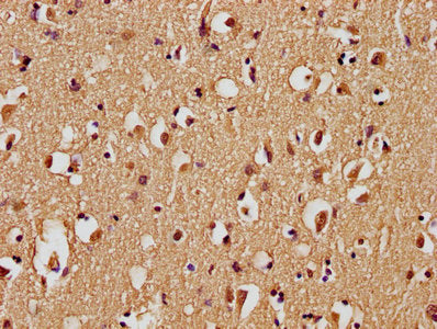 IHC image of CSB-PA868390PA01HU diluted at 1:100 and staining in paraffin-embedded human brain tissue performed on a Leica BondTM system. After dewaxing and hydration, antigen retrieval was mediated by high pressure in a citrate buffer (pH 6.0). Section was blocked with 10% normal goat serum 30min at RT. Then primary antibody (1% BSA) was incubated at 4°C overnight. The primary is detected by a biotinylated secondary antibody and visualized using an HRP conjugated SP system.