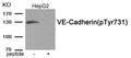Western blot analysis of extracts from HepG2 cells treated with Na3VO4 using Phospho-VE-Cadherin (Tyr731) antibody.The lane on the right is treated with the antigen-specific peptide.