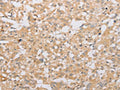 ATG9A Antibody – Figure 1 of 2