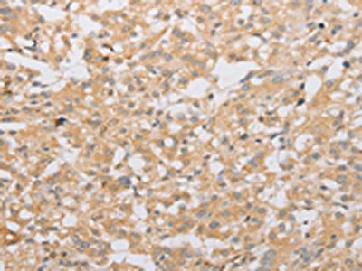 ATG9A Antibody – Figure 1 of 2
