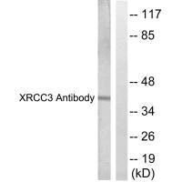 Western blot analysis of extracts from HepG2 cells, treated with Adriamycin (0.5uM, 5hours), using XRCC3 antibody.