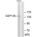 Western blot analysis of extracts from COLO cells, using CEP135 antibody.