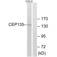 Western blot analysis of extracts from COLO cells, using CEP135 antibody.