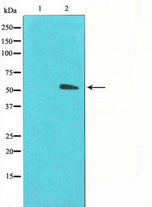 Western blot analysis on LOVO cell lysate using GLUT3 Antibody