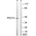 Western blot analysis of extracts from Jurkat cells, using PEX10 antibody.
