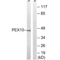 Western blot analysis of extracts from Jurkat cells, using PEX10 antibody.