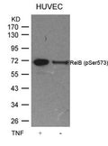Western blot analysis of extracts from HUVEC cells untreated or treated with TNF using RelB(Phospho-Ser573) Antibody.
