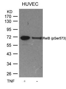 Western blot analysis of extracts from HUVEC cells untreated or treated with TNF using RelB(Phospho-Ser573) Antibody.