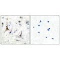 Immunohistochemical analysis of paraffin-embedded human brain tissue using PGP9.5 antibody.
