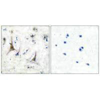 Immunohistochemical analysis of paraffin-embedded human brain tissue using PGP9.5 antibody.