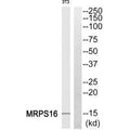 Western blot analysis of extracts from HepG2 cells, using MRPS16 antibody.