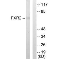 Western blot analysis of extracts from COLO205 cells, using FXR2 antibody.