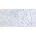 Immunohistochemistry analysis of paraffin-embedded human colon carcinoma tissue using NPHP4 antibody.
