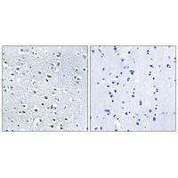 Immunohistochemistry analysis of paraffin-embedded human colon carcinoma tissue using NPHP4 antibody.