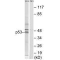 Western blot analysis of extracts from 293 cells, using p53 (Ab-378) antibody.