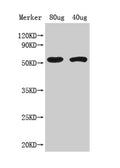 Western Blot
Positive WB detected in Recombinant protein
All lanes: ACS8 antibody at 1:1000
Secondary
Goat polyclonal to rabbit IgG at 1/50000 dilution
Predicted band size: 59 kDa
Observed band size: 59 kDa