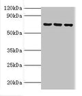 Western blot All lanes: ABCF2 antibody at 4ug/ml Lane 1: 293T whole cell lysate Lane 2: Hela whole cell lysate Lane 3: NIH/3T3 whole cell lysate Secondary Goat polyclonal to rabbit IgG at 1/10000 dilution Predicted band size: 72, 73 kDa Observed band size: 72 kDa