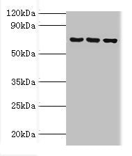 Western blot All lanes: ABCF2 antibody at 4ug/ml Lane 1: 293T whole cell lysate Lane 2: Hela whole cell lysate Lane 3: NIH/3T3 whole cell lysate Secondary Goat polyclonal to rabbit IgG at 1/10000 dilution Predicted band size: 72, 73 kDa Observed band size: 72 kDa