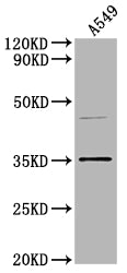 Western Blot
Positive WB detected in: A549 whole cell lysate
All lanes: OR5V1 antibody at 1:2000
Secondary
Goat polyclonal to rabbit IgG at 1/50000 dilution
Predicted band size: 37 kDa
Observed band size: 37 kDa