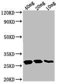 Western Blot
Positive WB detected in Recombinant protein
All lanes: TTYH2 antibody at 1:2000
Secondary
Goat polyclonal to rabbit IgG at 1/50000 dilution
Predicted band size: 22.88 kDa
Observed band size: 28 kDa
