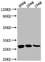 Western Blot
Positive WB detected in Recombinant protein
All lanes: TTYH2 antibody at 1:2000
Secondary
Goat polyclonal to rabbit IgG at 1/50000 dilution
Predicted band size: 22.88 kDa
Observed band size: 28 kDa