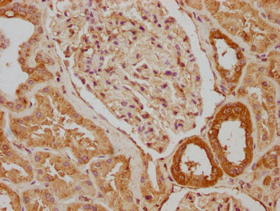 IHC image of CSB-PA872015LA01HU diluted at 1:640 and staining in paraffin-embedded human kidney tissue performed on a Leica BondTM system. After dewaxing and hydration, antigen retrieval was mediated by high pressure in a citrate buffer (pH 6.0). Section was blocked with 10% normal goat serum 30min at RT. Then primary antibody (1% BSA) was incubated at 4°C overnight. The primary is detected by a biotinylated secondary antibody and visualized using an HRP conjugated SP system.