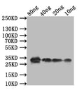Western Blot
Positive WB detected in: recombinant protein
All lanes:TCP21 Antibody at 1:1000
Secondary
Goat polyclonal to rabbit IgG at 1/50000 dilution
Predicted band size: 28.8 kDa
Observed band size: 33 kDa