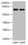Western blot
All lanes: ACTR8 antibody at 16µg/ml
Lane 1: A549 whole cell lysate
Lane 2: HCT116 whole cell lysate
Secondary
Goat polyclonal to rabbit IgG at 1/10000 dilution
Predicted band size: 71, 59, 37 kDa
Observed band size: 71 kDa