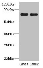 Western blot
All lanes: ACTR8 antibody at 16µg/ml
Lane 1: A549 whole cell lysate
Lane 2: HCT116 whole cell lysate
Secondary
Goat polyclonal to rabbit IgG at 1/10000 dilution
Predicted band size: 71, 59, 37 kDa
Observed band size: 71 kDa