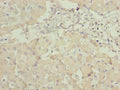 Immunohistochemistry of paraffin-embedded human liver tissue using CSB-PA872524LA01HU at dilution of 1:100