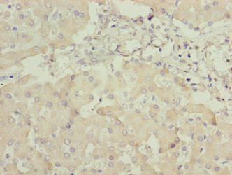 Immunohistochemistry of paraffin-embedded human liver tissue using CSB-PA872524LA01HU at dilution of 1:100