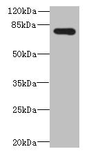 Western blot
All lanes: ADGRL4 antibody at 4µg/ml + Hela whole cell lysate
Secondary
Goat polyclonal to rabbit IgG at 1/10000 dilution
Predicted band size: 78 kDa
Observed band size: 78 kDa