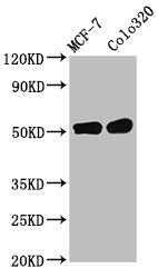 Western Blot
Positive WB detected in: MCF-7 whole cell lysate, Colo320 whole cell lysate
All lanes: DMAP1 antibody at 11µg/ml
Secondary
Goat polyclonal to rabbit IgG at 1/50000 dilution
Predicted band size: 53 kDa
Observed band size: 53 kDa