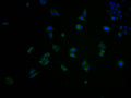 Immunofluorescence staining of Hela cells with CSB-PA873623OA01HU at 1:100, counter-stained with DAPI. The cells were fixed in 4% formaldehyde and blocked in 10% normal Goat Serum. The cells were then incubated with the antibody overnight at 4°C. The secondary antibody was Alexa Fluor 488-congugated AffiniPure Goat Anti-Rabbit IgG(H+L).