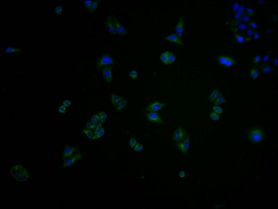 Immunofluorescence staining of Hela cells with CSB-PA873623OA01HU at 1:100, counter-stained with DAPI. The cells were fixed in 4% formaldehyde and blocked in 10% normal Goat Serum. The cells were then incubated with the antibody overnight at 4°C. The secondary antibody was Alexa Fluor 488-congugated AffiniPure Goat Anti-Rabbit IgG(H+L).