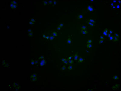 Immunofluorescence staining of Hela cells with CSB-PA873623PA01HU at 1:200, counter-stained with DAPI. The cells were fixed in 4% formaldehyde and blocked in 10% normal Goat Serum. The cells were then incubated with the antibody overnight at 4°C. The secondary antibody was Alexa Fluor 488-congugated AffiniPure Goat Anti-Rabbit IgG(H+L).