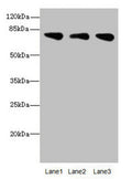 Western blot All lanes: ACSS2antibody at 2.14ug/ml Lane 1: Mouse liver tissue Lane 2: Mouse kidney tissue Lane 3: U87 whole cell lysate Secondary Goat polyclonal to rabbit IgG at 1/10000 dilution Predicted band size: 79, 81 kDa Observed band size: 79 kDa