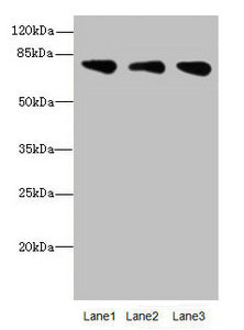 Western blot All lanes: ACSS2antibody at 2.14ug/ml Lane 1: Mouse liver tissue Lane 2: Mouse kidney tissue Lane 3: U87 whole cell lysate Secondary Goat polyclonal to rabbit IgG at 1/10000 dilution Predicted band size: 79, 81 kDa Observed band size: 79 kDa