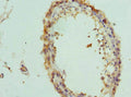 Immunohistochemistry of paraffin-embedded human testis tissue using CSB-PA873699ESR2HU at dilution of 1:100