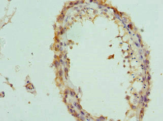 Immunohistochemistry of paraffin-embedded human testis tissue using CSB-PA873699ESR2HU at dilution of 1:100