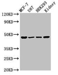 Western Blot
Positive WB detected in: MCF-7 whole cell lysate, U87 whole cell lysate, HEK293 whole cell lysate, Rat kidney tissue
All lanes: WWOX antibody at 3µg/ml
Secondary
Goat polyclonal to rabbit IgG at 1/50000 dilution
Predicted band size: 47, 42, 22, 5, 27, 36, 24 kDa
Observed band size: 47 kDa