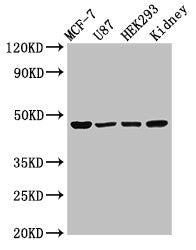 Western Blot
Positive WB detected in: MCF-7 whole cell lysate, U87 whole cell lysate, HEK293 whole cell lysate, Rat kidney tissue
All lanes: WWOX antibody at 3µg/ml
Secondary
Goat polyclonal to rabbit IgG at 1/50000 dilution
Predicted band size: 47, 42, 22, 5, 27, 36, 24 kDa
Observed band size: 47 kDa