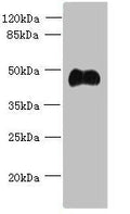 Western blot
All lanes: ABI3 antibody at 5ug/ml + Mouse heart tissue
Secondary
Goat polyclonal to rabbit IgG at 1/10000 dilution
Predicted band size: 40, 39 kDa
Observed band size: 40 kDa