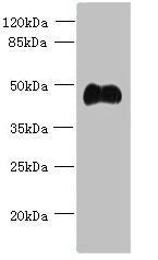 Western blot
All lanes: ABI3 antibody at 5ug/ml + Mouse heart tissue
Secondary
Goat polyclonal to rabbit IgG at 1/10000 dilution
Predicted band size: 40, 39 kDa
Observed band size: 40 kDa