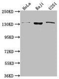 Western Blot
Positive WB detected in: Hela whole cell lysate, Raji whole cell lysate, U251 whole cell lysate
All lanes: LARS antibody at 1:2000
Secondary
Goat polyclonal to rabbit IgG at 1/50000 dilution
Predicted band size: 135, 129, 56 kDa
Observed band size: 135 kDa