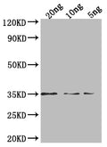 Western Blot
Positive WB detected in Recombinant protein
All lanes: PEN1 antibody at 1:2000
Secondary
Goat polyclonal to rabbit IgG at 1/50000 dilution
Predicted band size: 31.3 kDa
Observed band size: 35 kDa